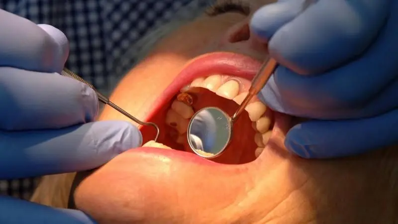 A Breakthrough in Tooth Enamel Regeneration: A New Hope for the Prevention and Treatment of Dental Caries